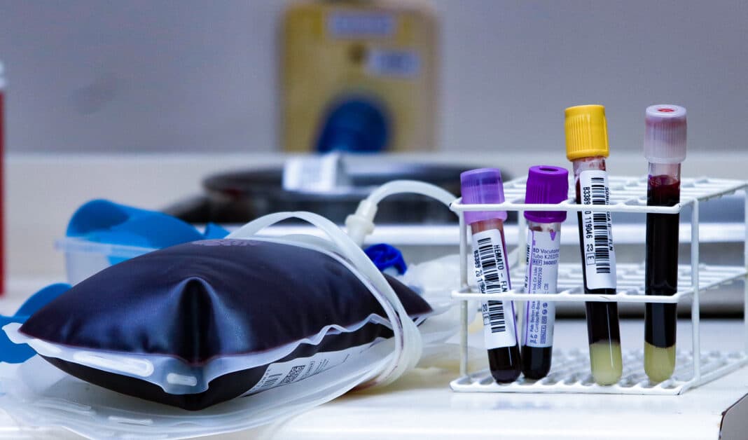 Hemosc de Joaçaba realiza nova coleta externa de sangue em Canoinhas - primeira página sc
